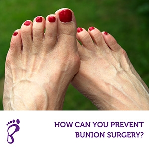 How Can You Prevent Bunion Surgery?